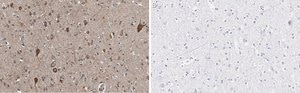 Anti-VGLUT2 Antibody, clone 8G9.2 ZooMAb® Mouse Monoclonal recombinant, expressed in HEK 293 cells
