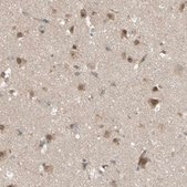 Anti-FLII antibody produced in rabbit Prestige Antibodies® Powered by Atlas Antibodies, affinity isolated antibody, buffered aqueous glycerol solution