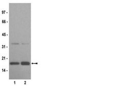 Anticuerpo anti-acetil-histona H3 (Lys14) serum, Upstate®