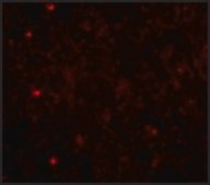 Anti-TOM70 antibody produced in rabbit affinity isolated antibody
