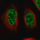 抗RBM26抗体 ウサギ宿主抗体 Prestige Antibodies® Powered by Atlas Antibodies, affinity isolated antibody, buffered aqueous glycerol solution