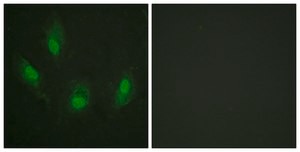 Anti-p53, antibody produced in rabbit affinity isolated antibody