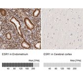 抗ESR1 ウサギ宿主抗体 Prestige Antibodies® Powered by Atlas Antibodies, affinity isolated antibody, buffered aqueous glycerol solution