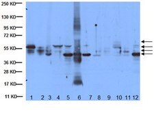 抗サイトケラチンAE1/AE3抗体 クローンAE1/AE3、酸性および塩基性サイトケラチンを認識 clone AE1/AE3, Chemicon&#174;, from mouse