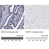 Anti-RSPH1 antibody produced in rabbit Prestige Antibodies® Powered by Atlas Antibodies, affinity isolated antibody, buffered aqueous glycerol solution