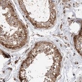 抗-MKL1 ウサギ宿主抗体 Prestige Antibodies® Powered by Atlas Antibodies, affinity isolated antibody, buffered aqueous glycerol solution