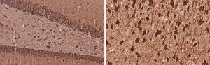 Anti-MAP2 Antibody, clone 3C19, ZooMAb® Rabbit Monoclonal recombinant, expressed in HEK 293 cells
