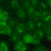 A549 Cells GFP-SMAD4