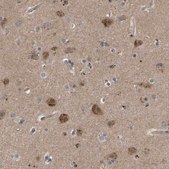 Anti-FIS1 antibody produced in rabbit Prestige Antibodies® Powered by Atlas Antibodies, affinity isolated antibody, buffered aqueous glycerol solution