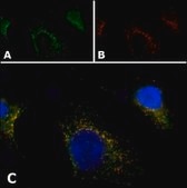 Anti-PMP70 antibody produced in rabbit affinity isolated antibody, buffered aqueous solution
