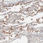 Anti-RAB11FIP1 antibody produced in rabbit Prestige Antibodies® Powered by Atlas Antibodies, affinity isolated antibody, buffered aqueous glycerol solution, Ab1