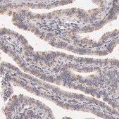 Anti-DDX3X antibody produced in rabbit Ab1, Prestige Antibodies® Powered by Atlas Antibodies, affinity isolated antibody, buffered aqueous glycerol solution