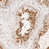 Anti-RPGR antibody produced in rabbit Prestige Antibodies® Powered by Atlas Antibodies, affinity isolated antibody, buffered aqueous glycerol solution