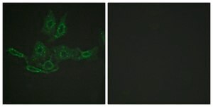 抗BCL-2 ウサギ宿主抗体 affinity isolated antibody