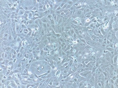 HL-1 Cardiac Muscle Cell Line HL-1 Cardiac Muscle Cell Line has been extensively characterized and is a valuable model system to address questions of cardiac biology at the cellular &amp; molecular levels.