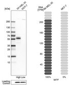 Anti-MITF antibody produced in rabbit Prestige Antibodies® Powered by Atlas Antibodies, affinity isolated antibody, buffered aqueous glycerol solution
