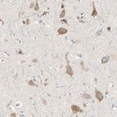 Anti-GRN antibody produced in rabbit Prestige Antibodies® Powered by Atlas Antibodies, affinity isolated antibody, buffered aqueous glycerol solution