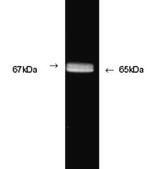 Anti-Glutamate Decarboxylase 65 &amp; 67 Antibody Chemicon®, from rabbit
