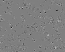 MCF7 Cell Line human NOTE: Both the cell line and DNA from the cell line may be available for this product. Please choose -1VL or VIAL for cells, or -DNA-5UG for DNA, 86012803, human breast (adenocarcinoma), Epithelial-like