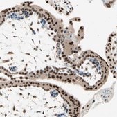 Anti-RNF43 antibody produced in rabbit Prestige Antibodies® Powered by Atlas Antibodies, affinity isolated antibody, buffered aqueous glycerol solution