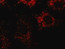 Anti-PMP70 antibody, Mouse monoclonal clone 70-18, purified from hybridoma cell culture