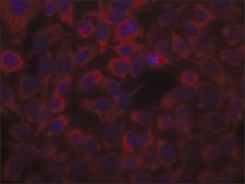 Anti-Actin (α-Sarcomeric) antibody, Mouse monoclonal clone 5C5, hybridoma cell culture supernatant