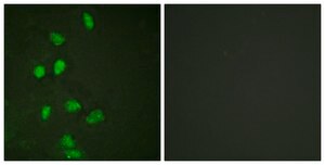 Anti-CHOP, N-Terminal antibody produced in rabbit affinity isolated antibody