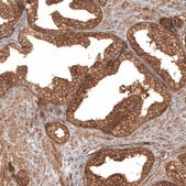 Anti-TAX1BP1 antibody produced in rabbit Prestige Antibodies® Powered by Atlas Antibodies, affinity isolated antibody, buffered aqueous glycerol solution