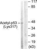 Anti-Acetyl (Lys 319) p53 Antibody, C-Terminal antibody produced in rabbit affinity isolated antibody
