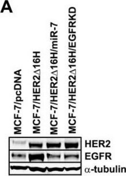 Anticuerpo anti-α-tubulina, clon DM1A clone DM1A, Upstate®, from mouse