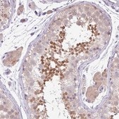Anti-DNAL1 antibody produced in rabbit Prestige Antibodies® Powered by Atlas Antibodies, affinity isolated antibody, buffered aqueous glycerol solution