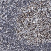 Anti-SIRT1 antibody produced in rabbit Prestige Antibodies® Powered by Atlas Antibodies, affinity isolated antibody, buffered aqueous glycerol solution