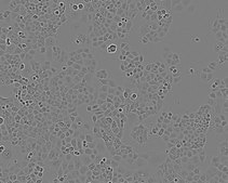 PANC-1 Cell Line human NOTE: Both the cell line and DNA from the cell line may be available for this product. Please choose -1VL or VIAL for cells, or -DNA-5UG for DNA, 87092802, human pancreas, Epithelial