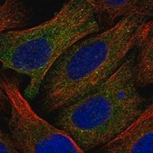 Anti-CALCOCO1 antibody produced in rabbit Prestige Antibodies® Powered by Atlas Antibodies, affinity isolated antibody, buffered aqueous glycerol solution