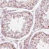Monoclonal Anti-BRD4 antibody produced in mouse Prestige Antibodies® Powered by Atlas Antibodies, clone CL1115, purified immunoglobulin, buffered aqueous glycerol solution