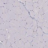 Anti-CCDC40 antibody produced in rabbit Prestige Antibodies® Powered by Atlas Antibodies, affinity isolated antibody, buffered aqueous glycerol solution