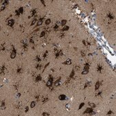 Anti-PFKP antibody produced in rabbit Prestige Antibodies® Powered by Atlas Antibodies, affinity isolated antibody, buffered aqueous glycerol solution