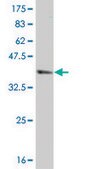 ANTI-SMAD4 antibody produced in mouse clone 3D7, purified immunoglobulin, buffered aqueous solution