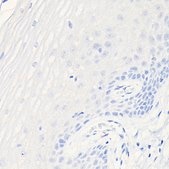 Anti-CDKN2A/p16INK4a antibody produced in mouse