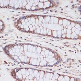 Anti-CDKN2A/p16INK4a antibody produced in rabbit