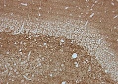 Anti-Synaptophysin Antibody, clone SY38 clone SY38, Chemicon®, from mouse