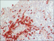 抗ヒトIgG (全分子)−ペルオキシダーゼ ウサギ宿主抗体 IgG fraction of antiserum, buffered aqueous solution