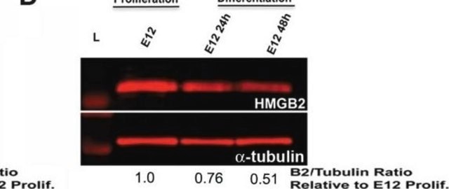 Anti-Tubulin Antibody, beta III isoform, CT, clone TU-20 (Similar to TUJ1) ascites fluid, clone TU-20 (Similar to TUJ1), Chemicon®