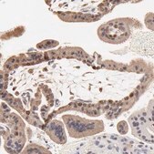 Anti-BIRC5 antibody produced in rabbit Prestige Antibodies® Powered by Atlas Antibodies, affinity isolated antibody, buffered aqueous glycerol solution