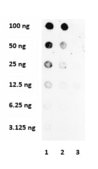 Anticuerpo anti-colágeno tipo I from rabbit, purified by affinity chromatography