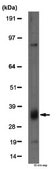 Anti-Cyclin D Antibody from rabbit, purified by affinity chromatography