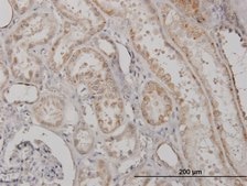 Monoclonal Anti-CLPP antibody produced in mouse clone 300, purified immunoglobulin, buffered aqueous solution