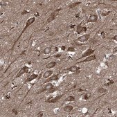 Anti-FOXRED2 antibody produced in rabbit Prestige Antibodies® Powered by Atlas Antibodies, affinity isolated antibody, buffered aqueous glycerol solution, ab1