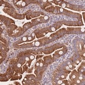 Anti-SMPD4 antibody produced in rabbit Prestige Antibodies® Powered by Atlas Antibodies, affinity isolated antibody, buffered aqueous glycerol solution