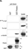 Anti-Parkin Antibody, clone PRK8 ascites fluid, clone PRK8, Chemicon®